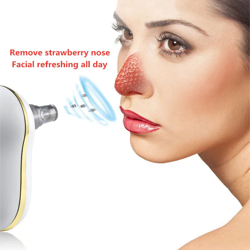 Limpiador eléctrico de puntos negros, máquina portátil personalizable para espinillas, limpieza profunda facial, succión al vacío, limpieza de la piel, máquina de belleza para el cuidado